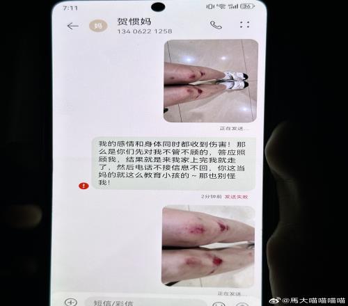 女子再晒受伤照喷贺惯母子：每次说的很好听，但每次都是欺骗