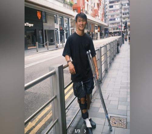 徐宏杰社媒谈伤势：相信对方也不是故意的，我回来时会更加强大