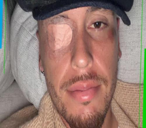 早日康复，阿根廷前国脚奥坎波斯左脸面瘫，已在接受治疗